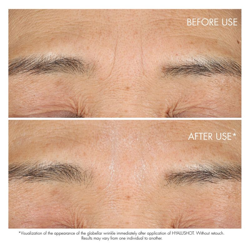 DIOR Capture Totale Hyalushot -Correttore Rughe – Rughe Consolidate E Primi Accenni Di Rughe