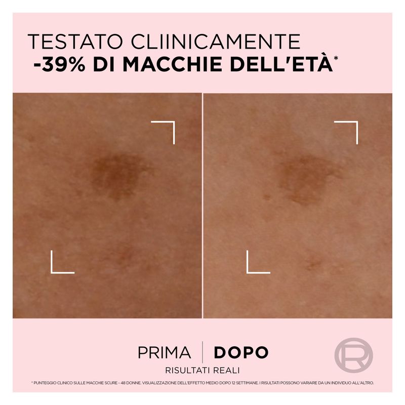 L'Oréal Age Perfect Anti-Macchie Siero Correttore Azione Rapida [Peonia + Niacinamide]