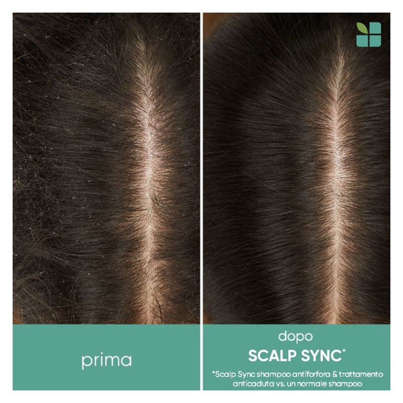 BIOLAGE Scalpsync, Trattamento Anticaduta Professionale in Fiale con Aminexil, 10 Fiale da 6 ml, per Uomo e Donna, contro la caduta temporanea