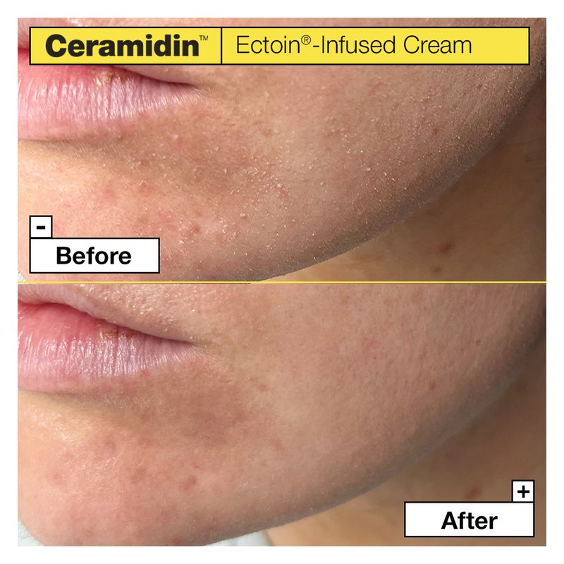 DR.JART+ - CERAMIDIN ECTOIN-INFUSED CREAM