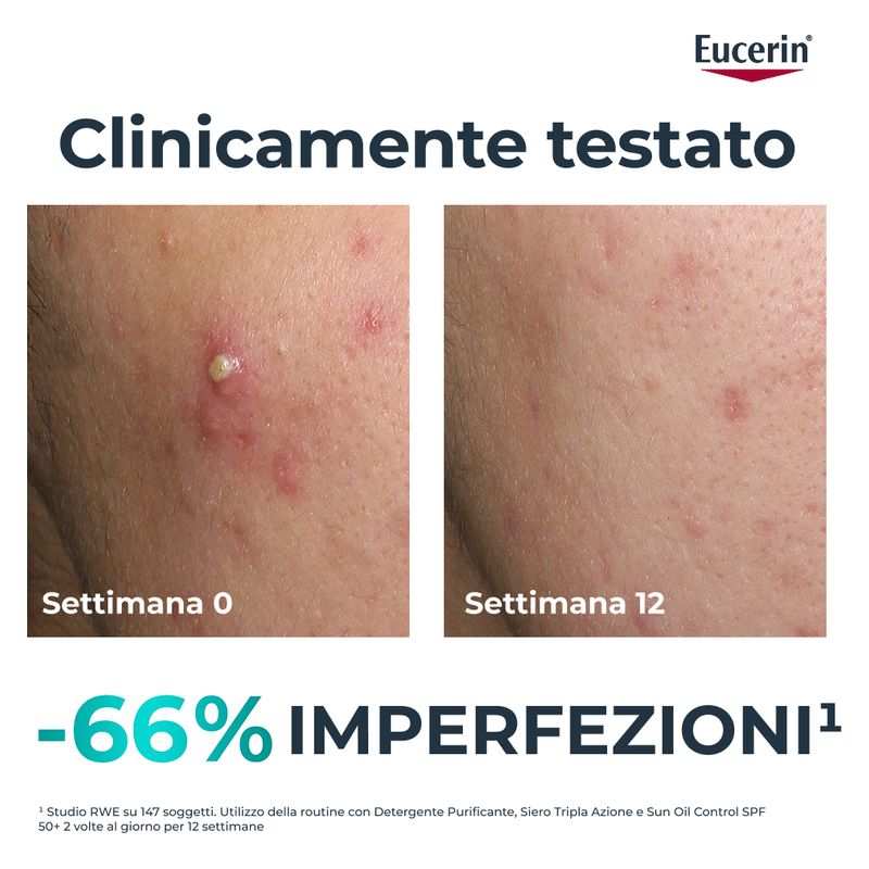 Eucerin - DERMOPURE CLINICAL TRIPLE ACTION SIERO TRIPLA AZIONE Eucerin - DERMOPURE CLINICAL TRIPLE ACTION SIERO TRIPLA AZIONE