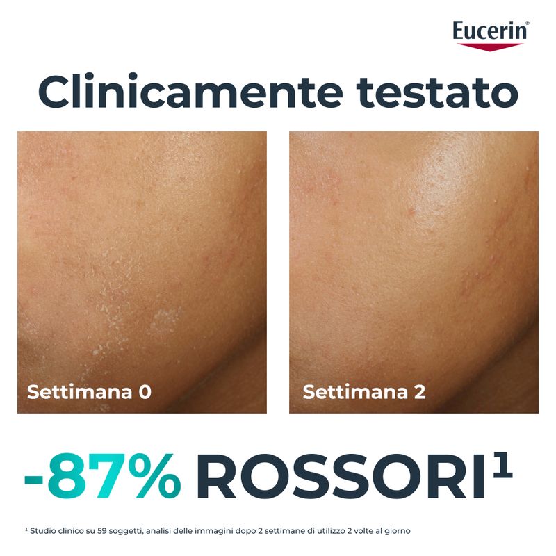 Eucerin - DERMOPURE CLINICAL HYDRA REPAIR TRATTAMENTO LENITIVO Eucerin - DERMOPURE CLINICAL HYDRA REPAIR TRATTAMENTO LENITIVO