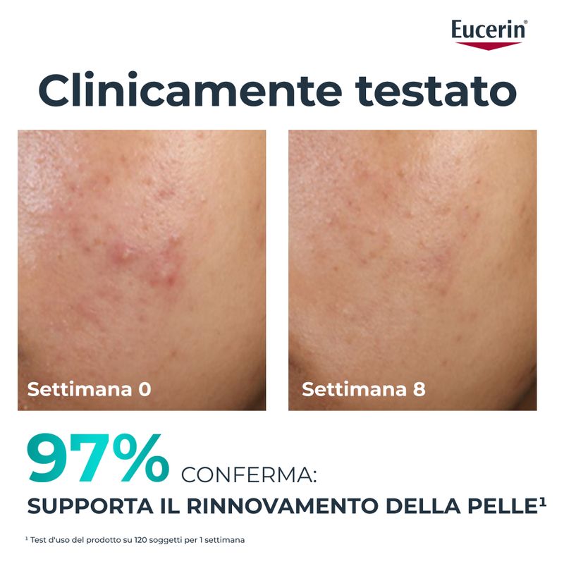 Eucerin - DERMOPURE CLINICAL PEELING 10 TRATTAMENTO RINNOVATORE Eucerin - DERMOPURE CLINICAL PEELING 10 TRATTAMENTO RINNOVATORE
