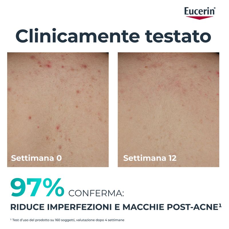 Eucerin - DERMOPURE CLINICAL CREMA CORPO TRIPLA AZIONE Eucerin - DERMOPURE CLINICAL CREMA CORPO TRIPLA AZIONE