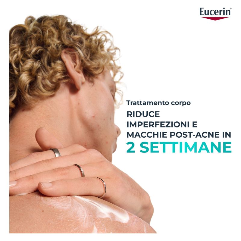 Eucerin - DERMOPURE CLINICAL CREMA CORPO TRIPLA AZIONE Eucerin - DERMOPURE CLINICAL CREMA CORPO TRIPLA AZIONE